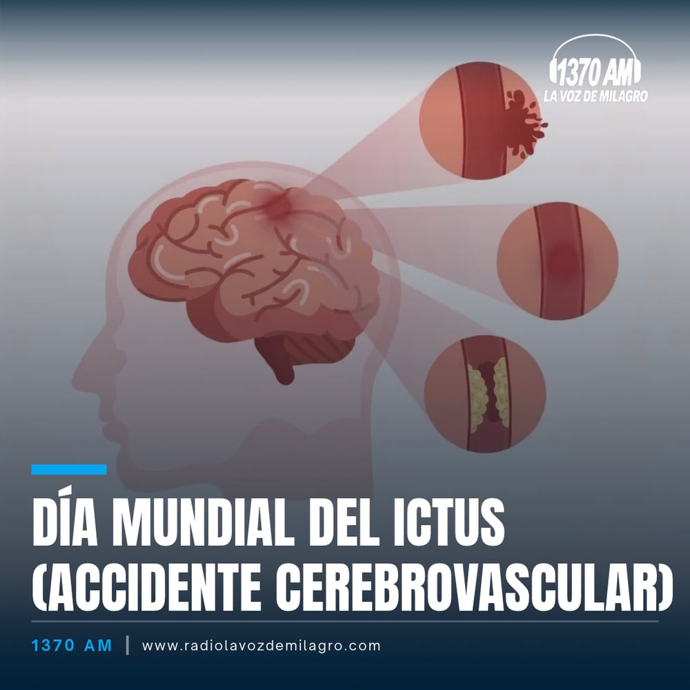 Ilustración de un cerebro con una zona de daño y tres arterias con ruptura, inflamación y obstrucción; texto Día Mundial del Ictus (Accidente Cerebrovascular).